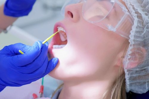 fluoride treatment fluoride treatment